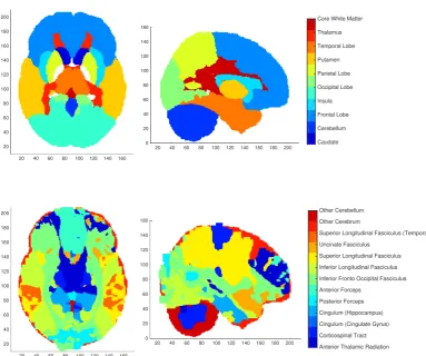 Figure 4.1:Visualisation of two brain parcellations into 11 regions of interestlargely based on functionality (top) and 13 regions of interest based on white mattertrack segmentations (bottom) based on the Johns-Hopkins brain atlas