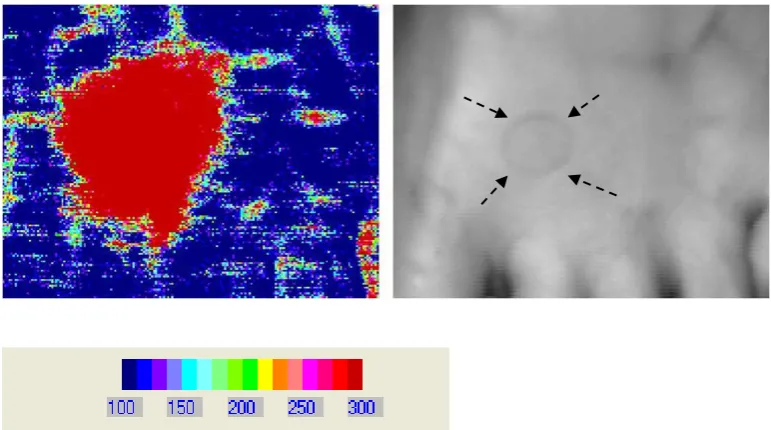Figure 4: The post stimulation (skin heating) laser Doppler image acquired using a 