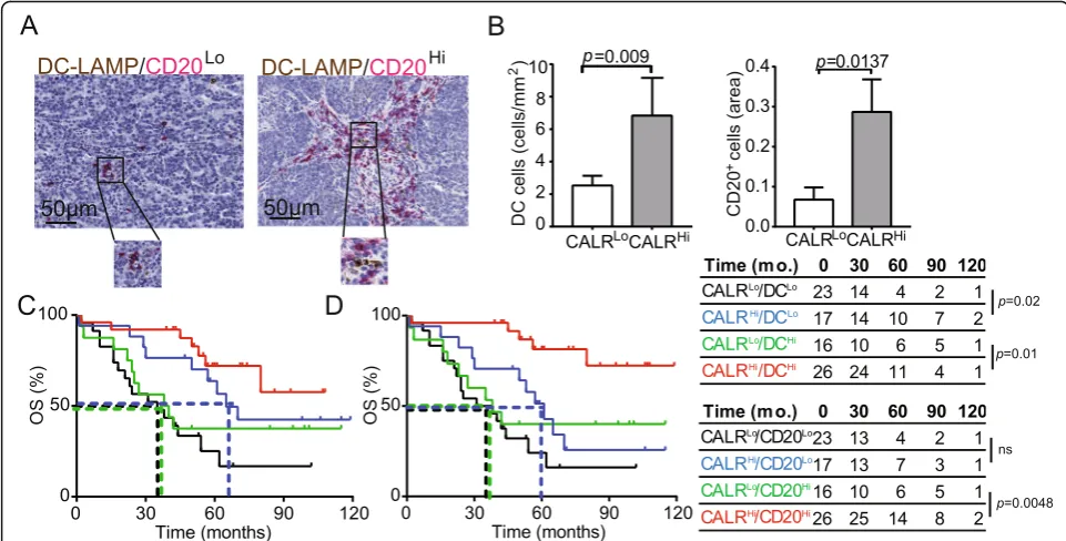 Fig. 4 CALR expression positively correlate with the frequency of mature DC-LAMP+ DCs and CD20+ B cells