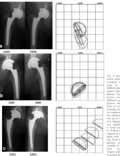 Fig. 2. Examples of three dif-ferent migration patterns: x-ray