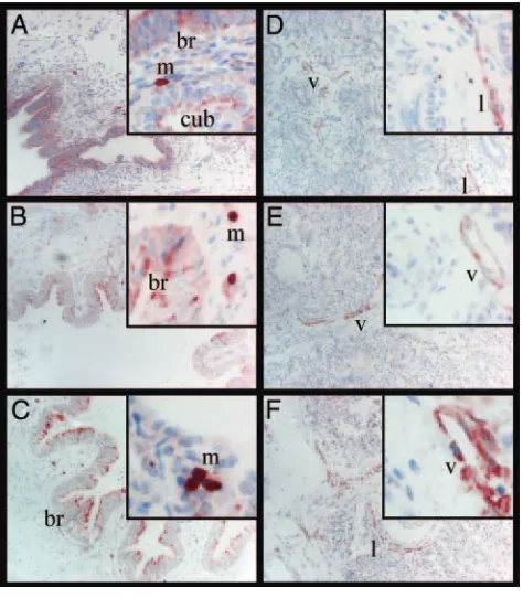 FIGURE 2Expression patterns of PlGF in the developing human lung.