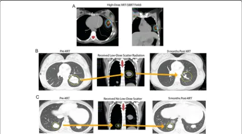 Fig. 2 Representative scans from a patient receiving scatter radiation to a low-dose lesion