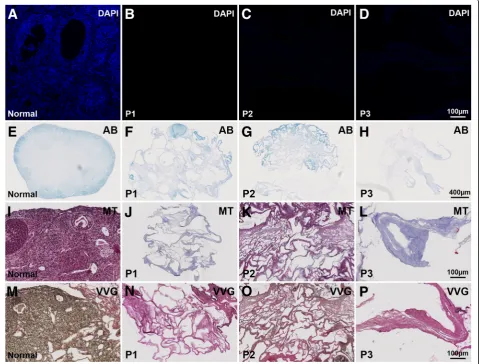 Fig. 3 Fluorescently DAPI-stained tissue sections (blue; a-d) indicated a successful removal of DNA from the decellularized tissue and only a faintblue could be visualized in protocol (P) 3-generated scaffolds