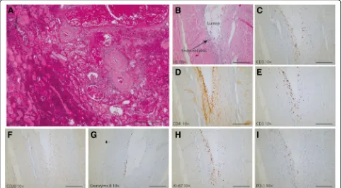 Fig. 3 Histology of the renal graft at the time of the kidney transplant biopsy and the explantation under nivolumab treatment (250explanted kidney.bar)