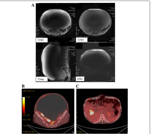 Fig. 1 a. MRI findings: Horizontal T2-weighted and T1-weighted MR imaging demonstrated a water component which showed a drop in signalintensity with fat