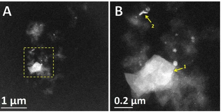 Figure 3. Aberration corrected-BF/HAADF-STEM imaging. APC were cut in ultra-thin sections of 90–95 nm for ultra-structural examination and location of electrodense materials, samples were not stained with heavy metals to avoid noise signals