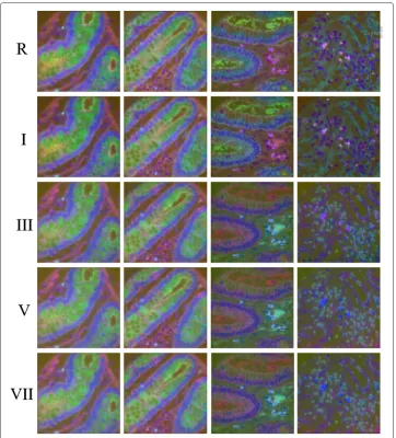 Fig. 2 Pseudocolor representation of normalization results. Column 1 to 4 represent four different cases: firsttwo columns are from histologically normal tissue and the last two are from cancerous tissue of the samepatient
