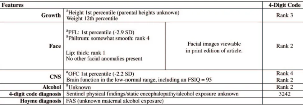 TABLE 5Example of a 14-year-old child who met the Hoyme FAS criteria but not the 4-Digit Code FAS criteria