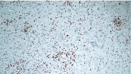 Figure 3.17: Area with Grade 0 CD3+ T-lymphocytes (CD3, 10x) 