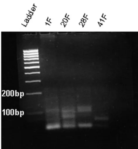 FIGURE 2of ASD children. These data are consistent with theNonspeciﬁcity of Uhlmann primer pairs: agarose gel demonstrating the nonspeciﬁcity ofrecently published ﬁndings of Afzal et al,38 who found nothe Uhlmann fusion primers with ASD samples
