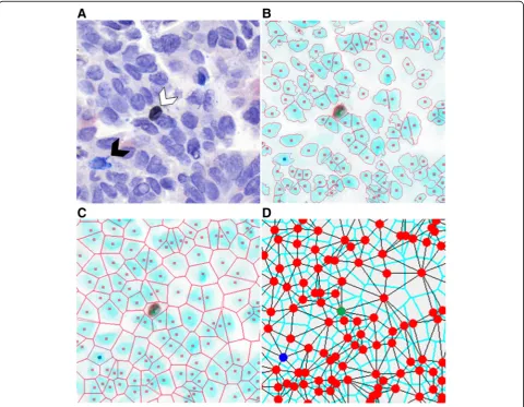 Fig. 1 Hyperspectral imaging of multicolor immunohistochemistry. a Example of a lung tumor section that was stained with multicolorimmunohistochemistry for CD3 (blue, black arrow), CD8 (dark brown, white arrow), CD79a (red) and counterstained with haematox