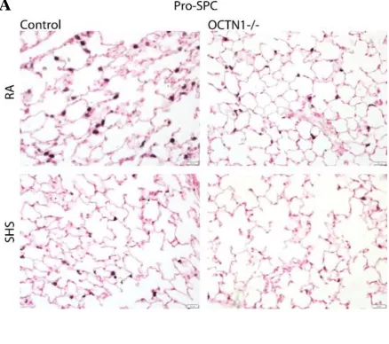 Figure 1.4: Histology of wildtype (WT) and silenced Octn1 (Ocnt1-/-) mouse lung exposed to room air (RA) and second-hand smoke (SHS)