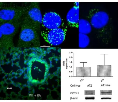 Figure 1.7: Immunolabelling of OCTN1 in NCI-H441, human alveolar epithelial cells (hAEpC) AT-II and hAEpC ATI-like differentiated cells
