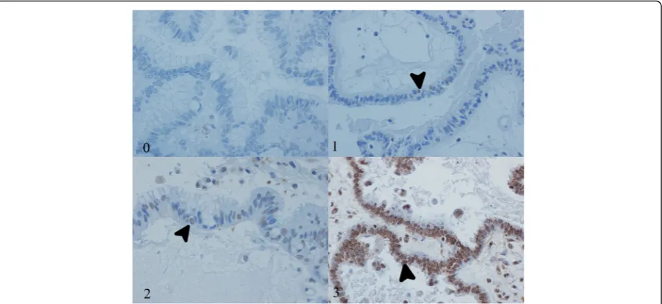 Fig. 2 Expression scores. Immunohistochemical scores: 0 (0 % positive nuclei), 1 (1–10 % positive nuclei), 2 (11–50 %) positive nuclei, 3 (51–100 %positive nuclei)