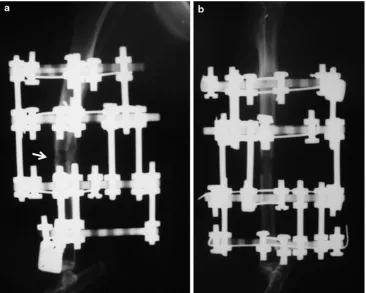 Fig. 3 Histopathologic examination of a rabbit in the experimentalgroup (a) and in the control group (b)