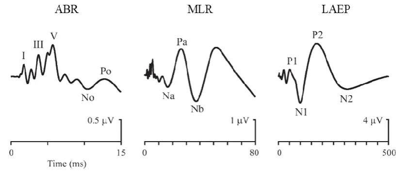 Figure 2.4: ABR, MLR, and LAEP 