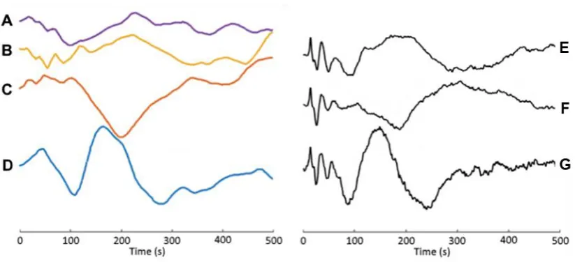 Figure 4.2: Grand Average Click Train vs. Grand Average Chirp Train LAEPs 