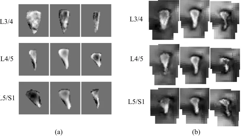 Figure 8: Successful convergence rate of compared methods on lumbar intervertebralslices L3/4, L4/5 and L5/S1