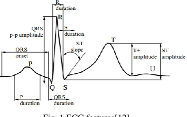 Table 1 ECG features derived 