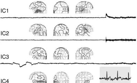 Figure 12: (From Vigário et al, 1998). Nine independent components found from the MEG data