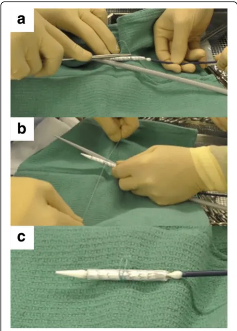 Fig. 2 How to prepare the ‘candy-plug’ device. a A 2–0 polyestersuture placed at the middle of the stent-graft to restrict opening ofthe stent-graft