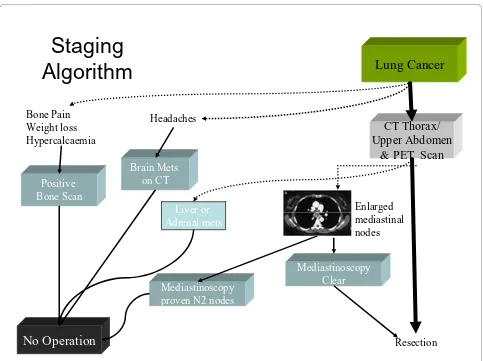 Figure 1 Staging algorithm for patients prior to carinal resection.