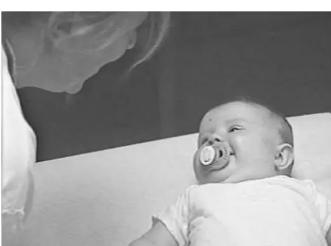 Fig 4. Case 4: Three-month-old female.