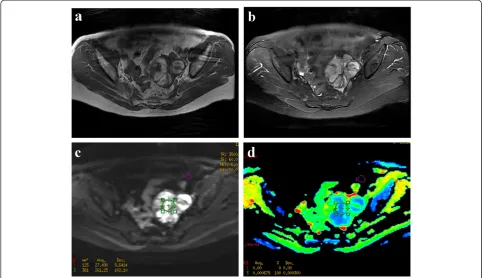 Table 4 The MRI components within four groups in 140 primary adnexal lesions