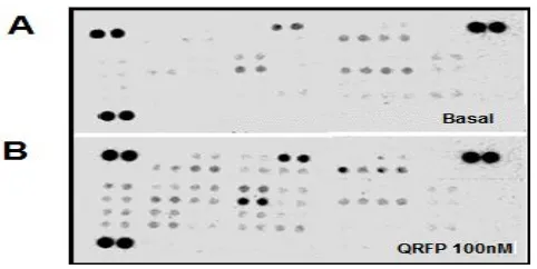Figure 5.1 The effects of QRFP on phosphorylated signaling proteins in PC3 cells. Representative Immunoblots showing multiplex detection of phosphorylated proteins in PC3 cells treated by dose dependent QRFP (1, 10 and100 nM) at time points 60 minutes of i