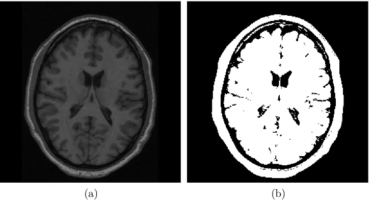 Figure 2.2: (a) MRI image of the brain. (b) The binary segmentation image obtainedby a thresholding method.