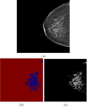 Figure 2.3: (a) A mammogram image of a dense breast. (b) The cluster of ﬁbrog-landular tissue region obtained by Bayes algorithm