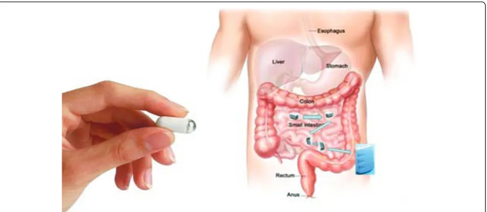 Figure 1 Wireless capsule endoscopy and multiple capsule networks.