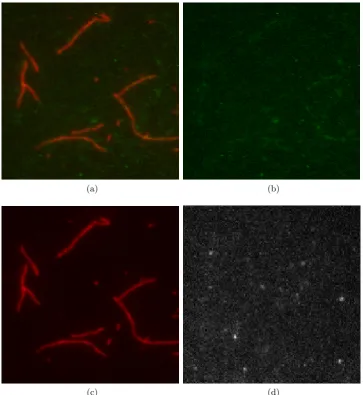 Figure 2.3: (a) is one sample frame from a two-channel TIRFM sequence of MyosinVI proteins, (b) and (c) are the Green and Red channels of (a) respectively, and (d)is a sample frame from a single-channel TIRFM sequence of Myosin VI proteins.