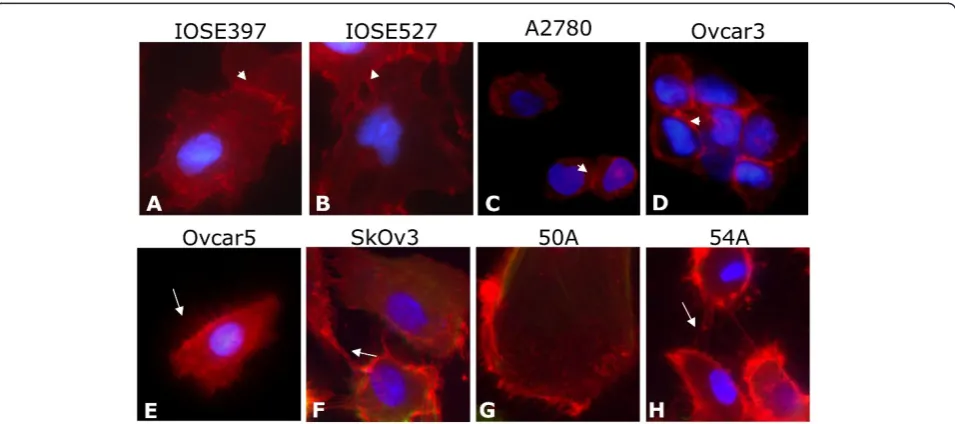 Figure 2 CD151 qRT-PCR mRNA expression levels in patient-derived ascites cell lines. Patient-derived ascites cell lines, immortalized OSE,and EOC cell lines express CD151.