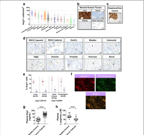 Fig. 8 Arginase 1 is abundant in multiple types of cancer.normal human tissues ( a Immunohistochemistry of human tumor tissue microarrays stained with an anti-Arg1antibody were quantified for Arg1-positive infiltrating granulocytes by digital histopatholog