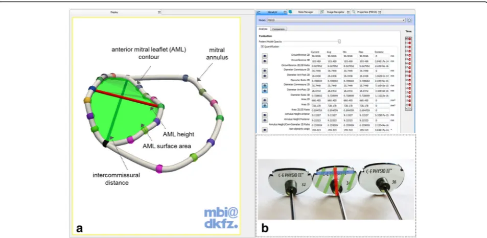 Fig. 1 a Screenshot of the MITK Mitralyzer plugin with a modelled mitral annulus and anterior mitral leaflet