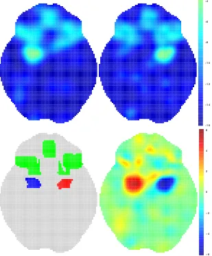 Figure 4.4: Results for simulation setup 2 of Section 4.4.2. Same layout as Figure4.3 (see that caption for details), except here slice z = �16 of the brain is shown.