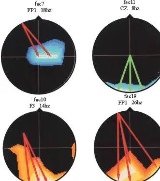 Fig 2. EEG coherence measures at 2versus experimental (are 4 heads, each corresponding to aused coherence factor, top view, scalpleft to image left