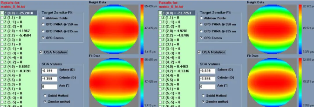 Fig. 3. Effect of the hyperopic shift and coupling factor in the ablative refractive correction
