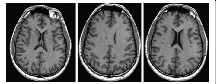 Figure 1 Left: template image, middle: reference image, right: registered image.
