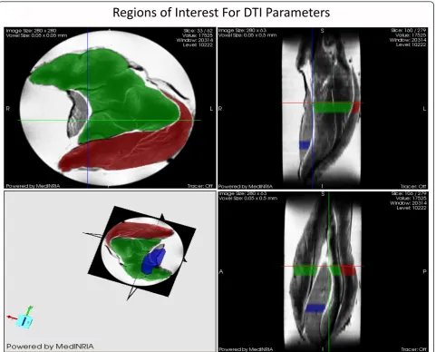 Figure 2 Diffusion tensor imaging (DTI) of Rat Skeletal Muscle with Regions of Interest for the analysis