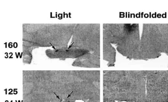 Fig 5. Autoradiograph images of preterm baboon brainsections showing SCN 2-deoxyglucose uptake after lightexposure at night
