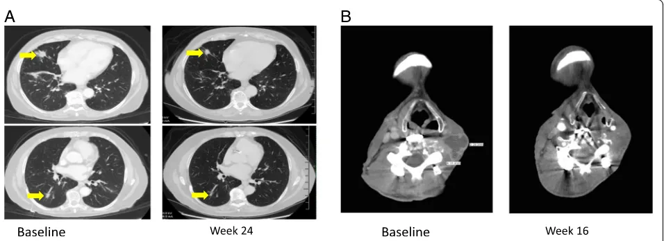 Fig. 1 alower, 0.6 cm), Lung metastases in BCC patient indicated by yellow arrows at baseline (upper, 1.6 cm; lower 1.4 cm), left, and at Week 24 (upper, 1.3 cm; right