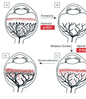 Fig 1. The proposed role of VEGF. A, It is hypoth-esized that normal retinal vessel development isstimulated by production of VEGF (red) anterior tothe developing vasculature