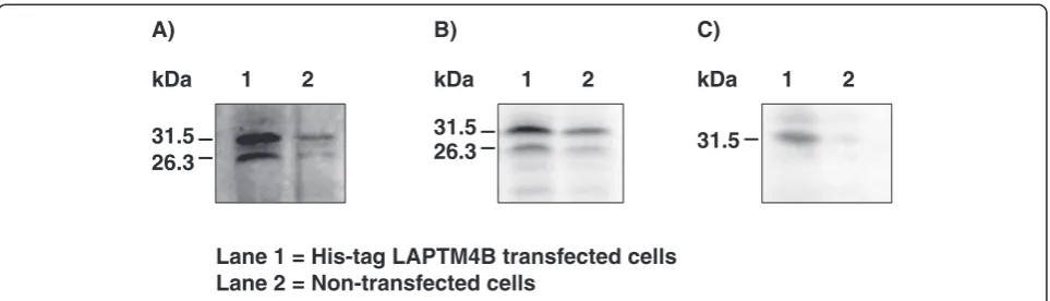 Figure 4 Overexpression analysis of LAPTM4B in HEK cells. LAPTM4B was cloned into the his-tag pQE2 vector and used to transfect HEK cells.Proteins were extracted and subjected to immunoblotting using the anti-bovine (LA)2-LAPTM4B polyclonal antibody (panel