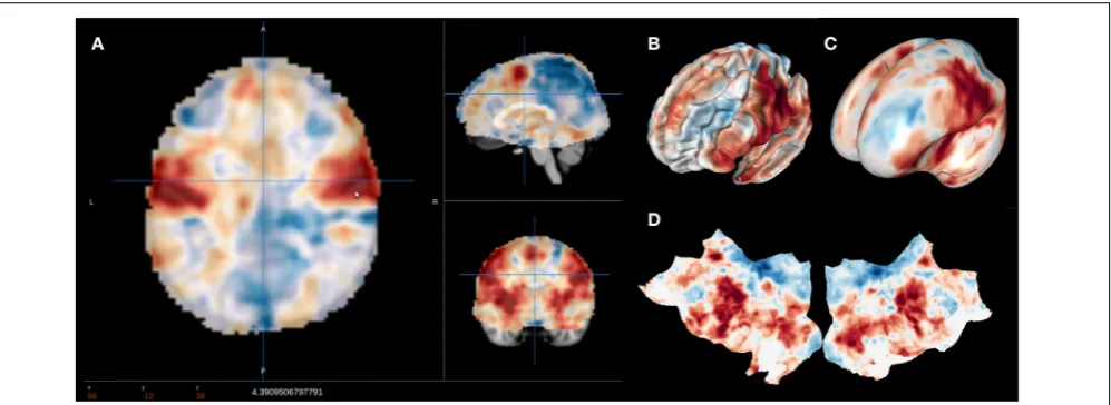 FIGURE 2 | Visualization options available in NeuroVault. The user can choose to interactively interrogate the images using 2D volumetric viewview (A), 3D ﬁducial (B), 3D inﬂated view (C), or a ﬂattened cortical surface map (D).