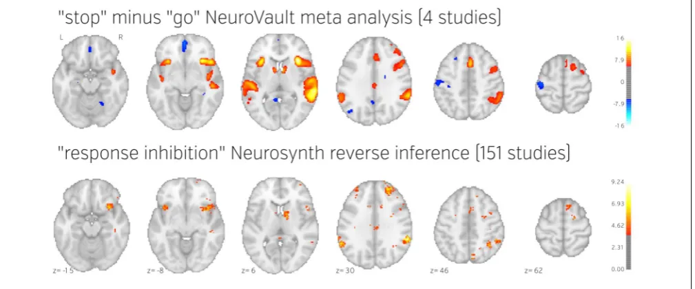 FIGURE 5 | Comparison of image based and coordinate basedmeta analysis of response inhibition