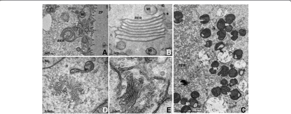 Figure 4 Well-developed rough (A and B) and smooth (C) endoplasmic reticulum and Golgi complex (D and E) in secondaryfollicle oocytes