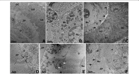 Figure 5 Development of the zona pellucida (ZP) and cortical granules during follicular growth