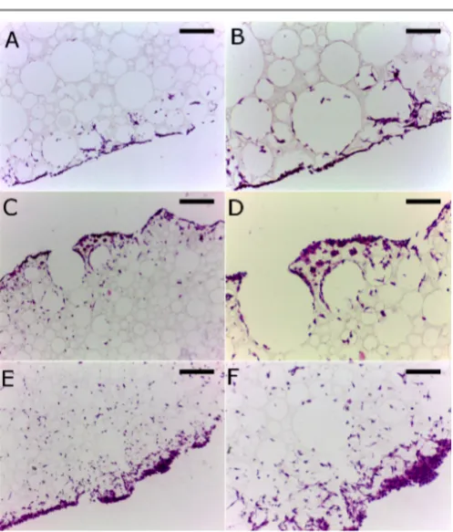 Figure 
  7: 
  Proposed 
  ultimate 
  degradation 
  products 
  of 
  PCL-­‐TA 
  scaffolds 
  and 
  previously 
  reported 
  DPEHA 
  and 
  TMPTA 
  scaffolds